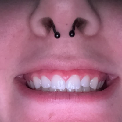 After