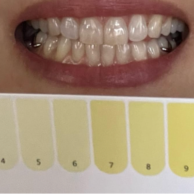 Before